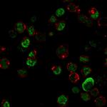 Neurofilament (NF-L) (Neuronal Marker) Monoclonal Antibody (NR-4)