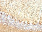 Neurofilament (NF-L) (Neuronal Marker) Monoclonal Antibody (NFL/736)