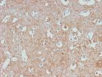 Neurofilament (NF-L) Recombinant Rabbit Monoclonal Antibody (NEFL, 2983R)
