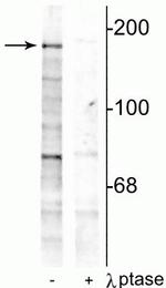 Phospho-NMDAR2B (Tyr1252) Polyclonal Antibody