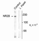 Phospho-NMDA NR2B (Tyr1336) Antibody in Western Blot (WB)