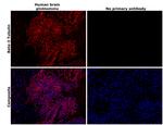 beta Tubulin Antibody in Immunohistochemistry (Paraffin) (IHC (P))