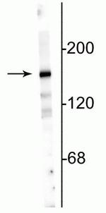 NMDAR2A Polyclonal Antibody