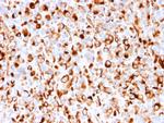 NGF-Receptor (p75)/CD271 Antibody in Immunohistochemistry (Paraffin) (IHC (P))