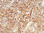 NGF-Receptor (p75)/CD271 (Soft Tissue Tumor Marker) Recombinant Mouse Monoclonal Antibody (rNGFR/8824)