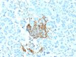 NGF-Receptor (p75)/CD271 Monoclonal Antibody (NGFR, 1964)