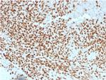 NKX2.2 (Neuroendocrine and Ewing's Sarcoma Marker) Monoclonal Antibody (NX2/1523)