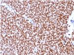 NKX2.2 Recombinant Mouse Monoclonal Antibody (rNX2, 294)