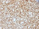 NKX2.2 Antibody in Immunohistochemistry (Paraffin) (IHC (P))