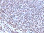 NKX2.2 Recombinant Rabbit Monoclonal Antibody (NX2, 2198R)