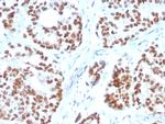 NKX3.1 Monoclonal Antibody (NKX3.1, 3350)
