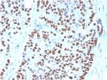 NKX3.1 (Metastatic Prostate Adenocarcinoma Marker) Monoclonal Antibody (NKX3.1/3348)