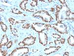 NKX3.1 Recombinant Rabbit Monoclonal Antibody (NKX3.1, 4562R)