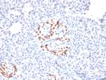 NKX6.1 (Marker for Pancreatic and Duodenal Neuroendocrine Tumors) Monoclonal Antibody (NKX61/2561)