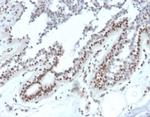 Nucleoside Diphosphate Kinase A/nm23-H1 Monoclonal Antibody (NME1/2738)