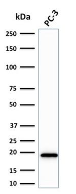 NME2/nm23-H2/NDPK-B (Suppressor of Metastasis) Antibody in Western Blot (WB)