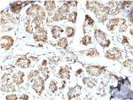 NME2/nm23-H2/NDPK-B (Suppressor of Metastasis) Monoclonal Antibody (CPTC-NME2-2)