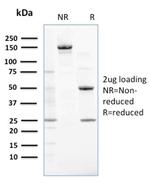 NME2/nm23-H2/NDPK-B (Suppressor of Metastasis) Antibody in SDS-PAGE (SDS-PAGE)