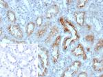 NME2/nm23-H2/NDPK-B (Suppressor of Metastasis) Monoclonal Antibody (NME2/12061)