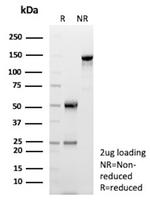 NME2/nm23-H2/NDPK-B (Suppressor of Metastasis) Antibody in SDS-PAGE (SDS-PAGE)