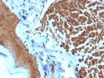 NME2/nm23-H2/NDPK-B (Suppressor of Metastasis) Antibody in Immunohistochemistry (Paraffin) (IHC (P))
