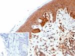 NME2/nm23-H2/NDPK-B (Suppressor of Metastasis) Antibody in Immunohistochemistry (Paraffin) (IHC (P))