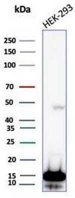 NME2/nm23-H2/NDPK-B (Suppressor of Metastasis) Antibody in Western Blot (WB)