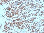 NME2/nm23-H2/NDPK-B (Suppressor of Metastasis) Antibody in Immunohistochemistry (Paraffin) (IHC (P))