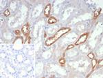 NME2/nm23-H2/NDPK-B (Suppressor of Metastasis) Monoclonal Antibody (NME2/6436)