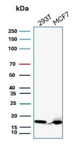 NME2/nm23-H2/NDPK-B (Suppressor of Metastasis) Antibody in Western Blot (WB)