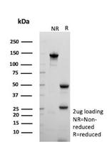 NME2/nm23-H2/NDPK-B (Suppressor of Metastasis) Antibody in SDS-PAGE (SDS-PAGE)
