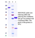 NME2/nm23-H2/NDPK-B (Suppressor of Metastasis) Antibody in SDS-PAGE (SDS-PAGE)
