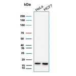 NME2/nm23-H2/NDPK-B (Suppressor of Metastasis) Recombinant Rabbit Monoclonal Antibody (NME2/12953R)