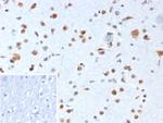 Nucleophosmin (Acute Myeloid Leukemia Marker) Recombinant Mouse Monoclonal Antibody (rNPM1/8056)