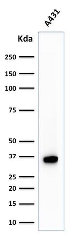 Nucleophosmin Antibody in Western Blot (WB)