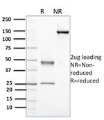 Nucleophosmin (Acute Myeloid Leukemia Marker) Antibody in SDS-PAGE (SDS-PAGE)