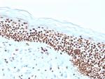 Nucleophosmin Recombinant Mouse Monoclonal Antibody (rNPM1, 1901)