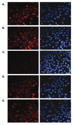 H3K36me1 Antibody in Immunocytochemistry (ICC/IF)