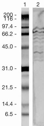 SUZ12 Antibody in Western Blot (WB)