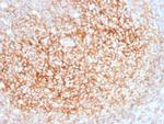 CD73 (Immuno-Oncology Target) Antibody in Immunohistochemistry (Paraffin) (IHC (P))