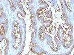 CD73 (Immuno-Oncology Target) Antibody in Immunohistochemistry (Paraffin) (IHC (P))