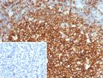 CD73 (Immuno-Oncology Target) Antibody in Immunohistochemistry (Paraffin) (IHC (P))