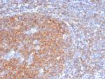 CD73 (Immuno-Oncology Target) Antibody in Immunohistochemistry (Paraffin) (IHC (P))