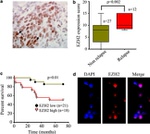 EZH2 Antibody in Immunohistochemistry, Immunocytochemistry (IHC, ICC/IF)
