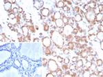 NTRK2 (Neurotrophic Receptor Tyrosine Kinase 2) Antibody in Immunohistochemistry (Paraffin) (IHC (P))