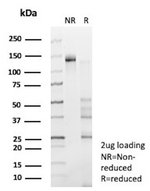 NTRK3 (Neurotrophic Receptor Tyrosine Kinase 3) Antibody in SDS-PAGE (SDS-PAGE)