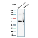 NTRK3 (Neurotrophic Receptor Tyrosine Kinase 3) Antibody in Western Blot (WB)