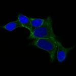 Ornithine Decarboxylase-1 (ODC-1) Monoclonal Antibody (ODC1/487)