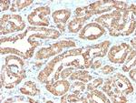 Ornithine Decarboxylase-1 (ODC-1) Recombinant Rabbit Monoclonal Antibody (ODC1, 2878R)
