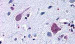 HTR2B Antibody in Immunohistochemistry (Paraffin) (IHC (P))